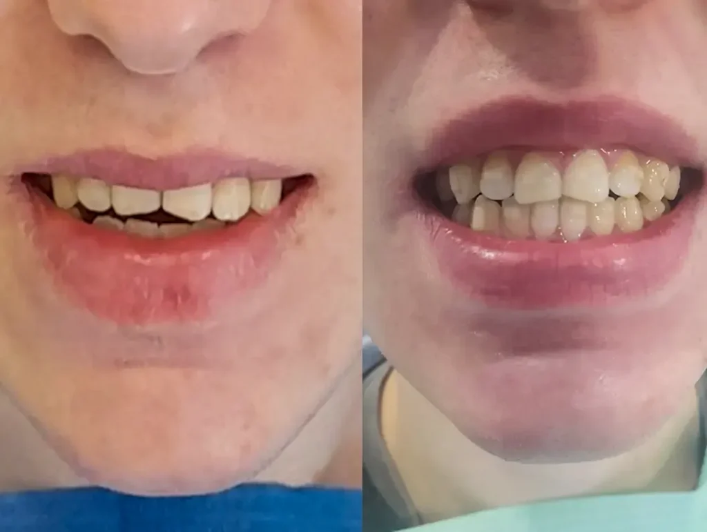 Dr Vukicevic Invisalign iTero skener