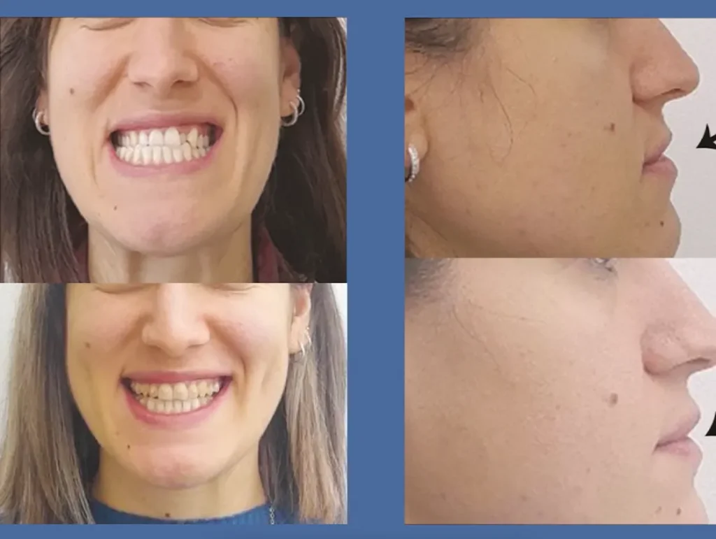 Dr Vukicevic Invisalign iTero skener
