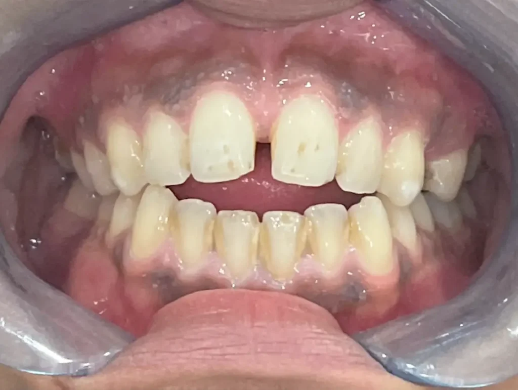 Dr Vukicevic Invisalign iTero skener